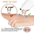 5-in-1 Blackhead Remover | Clear Skin in Seconds