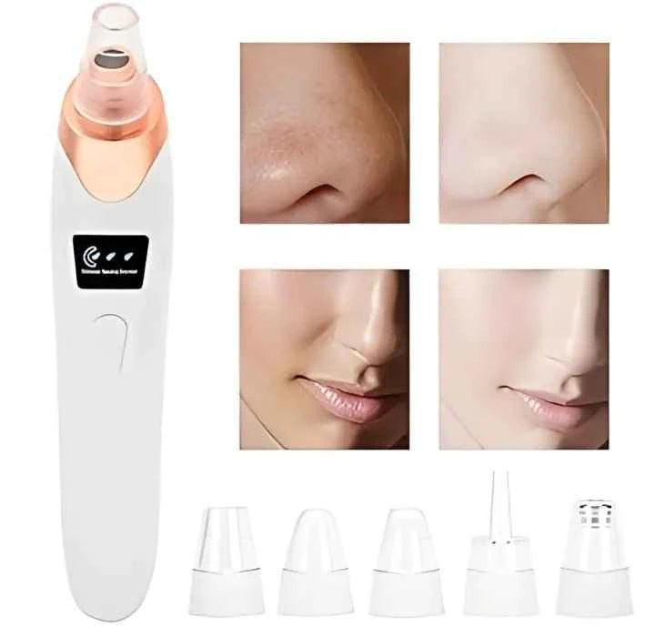 5-in-1 Blackhead Remover | Clear Skin in Seconds
